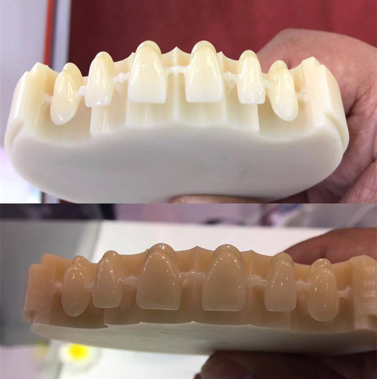 Multi layer dental pmma restoration effect