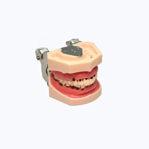 Dental Stone Removal Training Model, $78.00, August 2024 - Dental Lab Shop