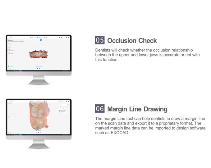 intraoral scanner function application